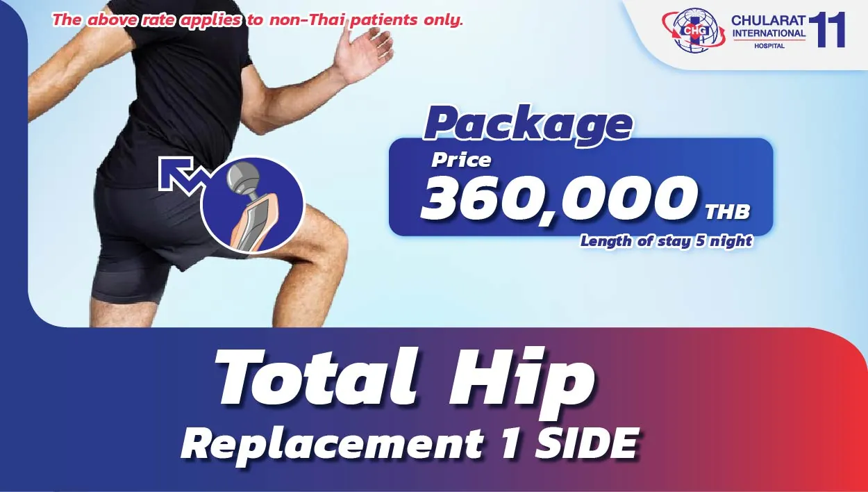 Total Hip Replacement
