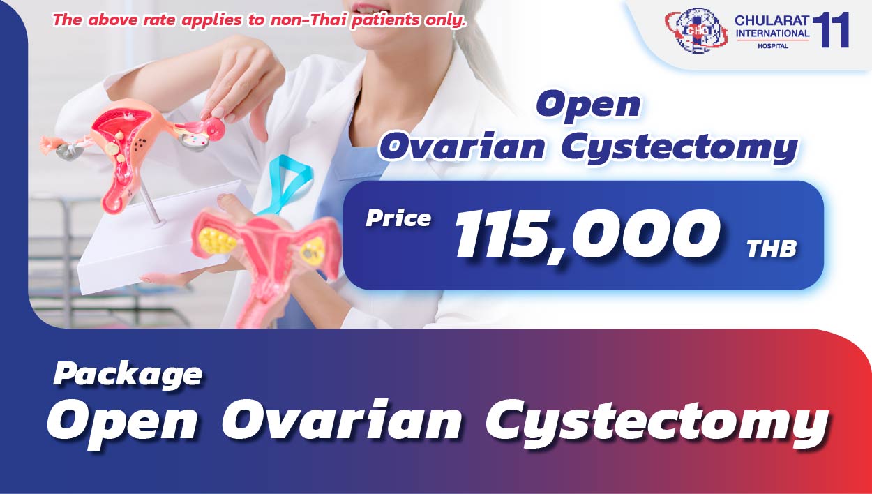 Open Ovarian Cystectomy