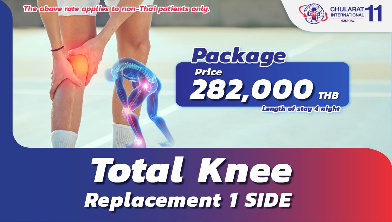 Total Knee Replacement 1 SIDE