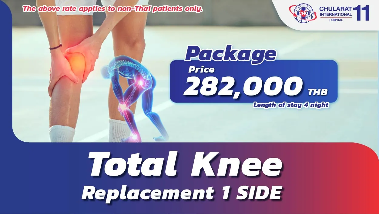 Total Knee Replacement 1 SIDE