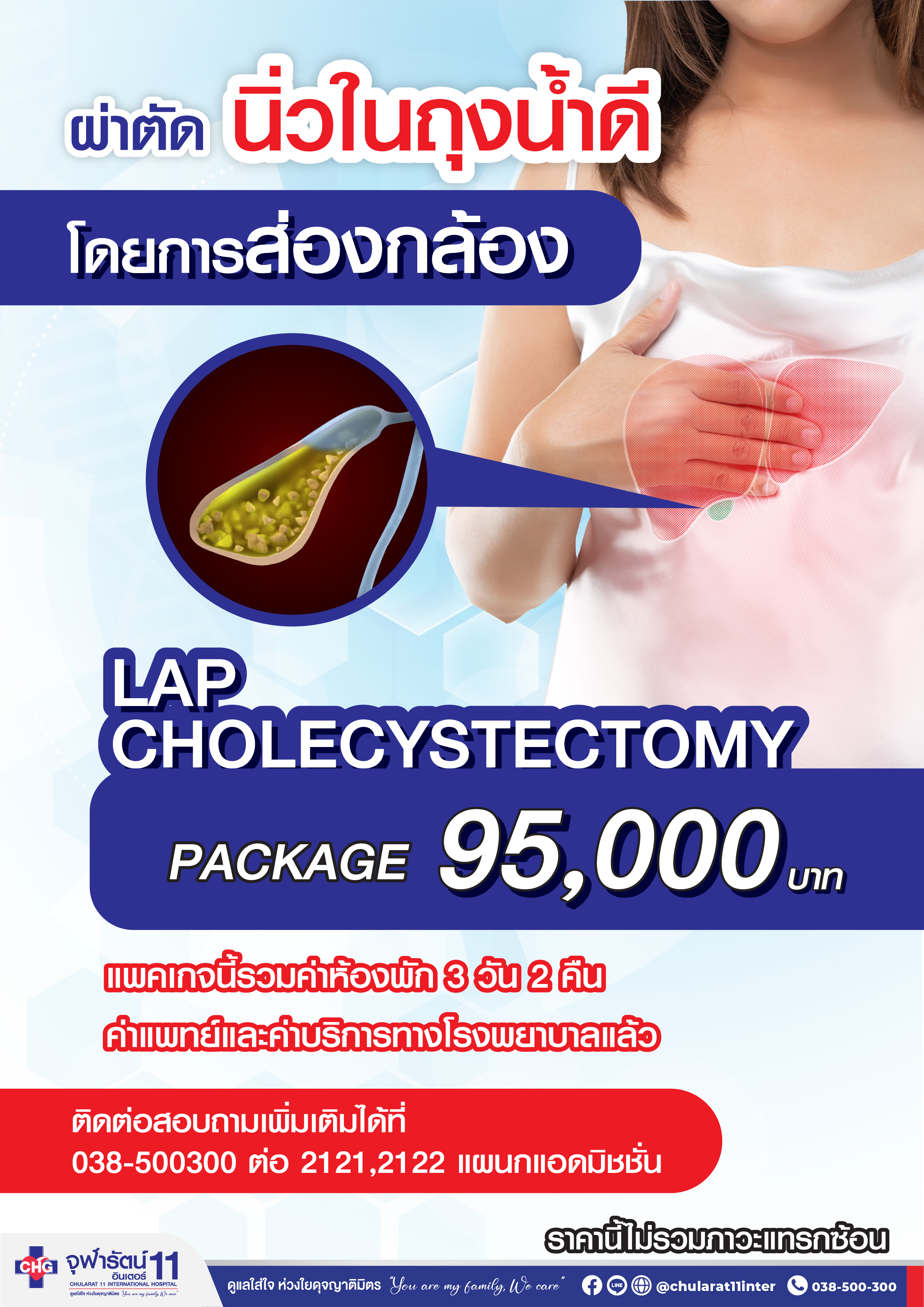 ผ่าตัด นิ่วในถุงน้ำดี ด้วยการส่องกล้อง - แพ็คเกจโปรโมชั่น - โรงพยาบาลจุฬารัตน์ 11 อินเตอร์