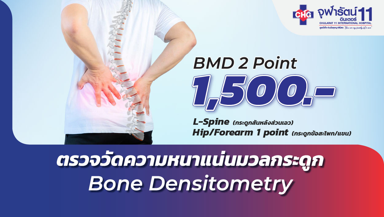 ตรวจวัดความหนาแน่นมวลกระดูก