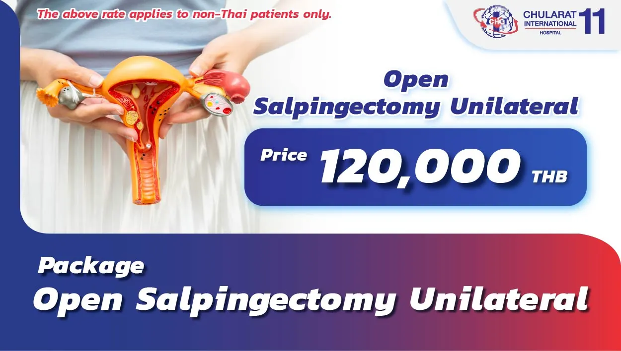 Open Salpingectomy Unilateral